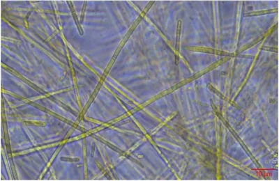 Conference-Les-Cyanobacteries-toxiques-mais-pas-que-Fete-de-la-Science-8211-10-10-2025-8211-Parentis-en-Born_3168644